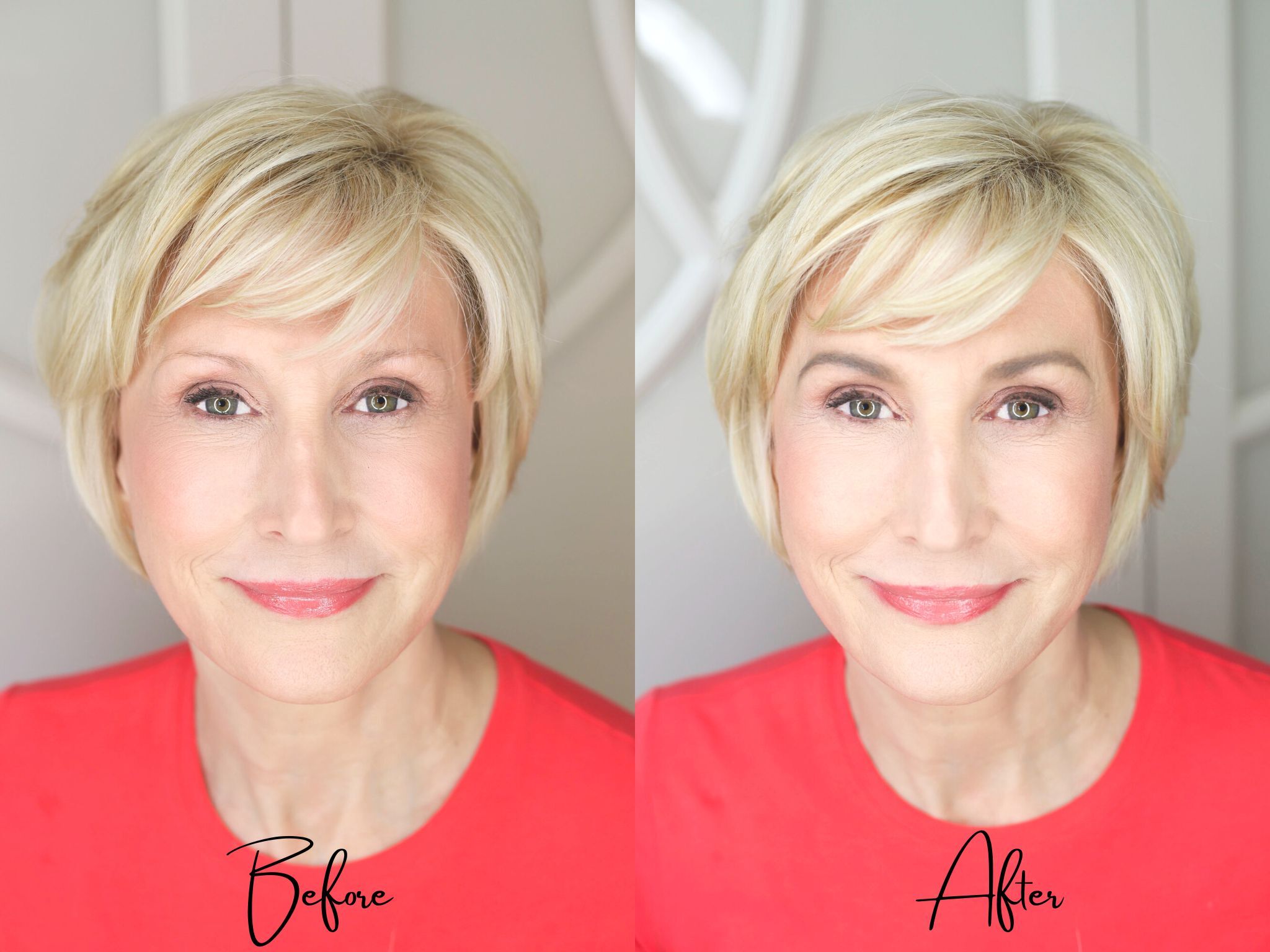 before-after-smilingface (1)