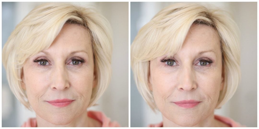 before-and-after